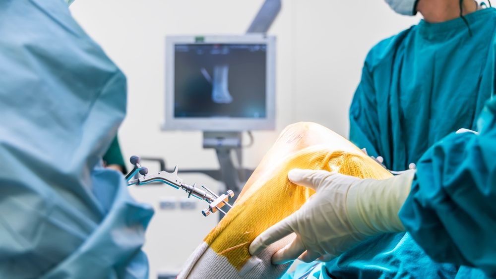 A Robotic Knee Replacement Guide For Seniors